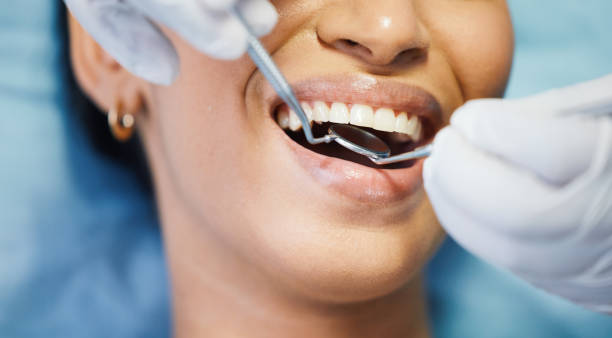 Best Knocked-Out Tooth Emergency  in Hiawatha, KS